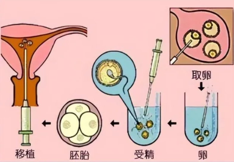 正常情况下等到卵泡多大才能取卵？有哪些注意的？