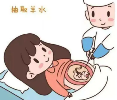 女性抗精子抗体可以做试管吗？